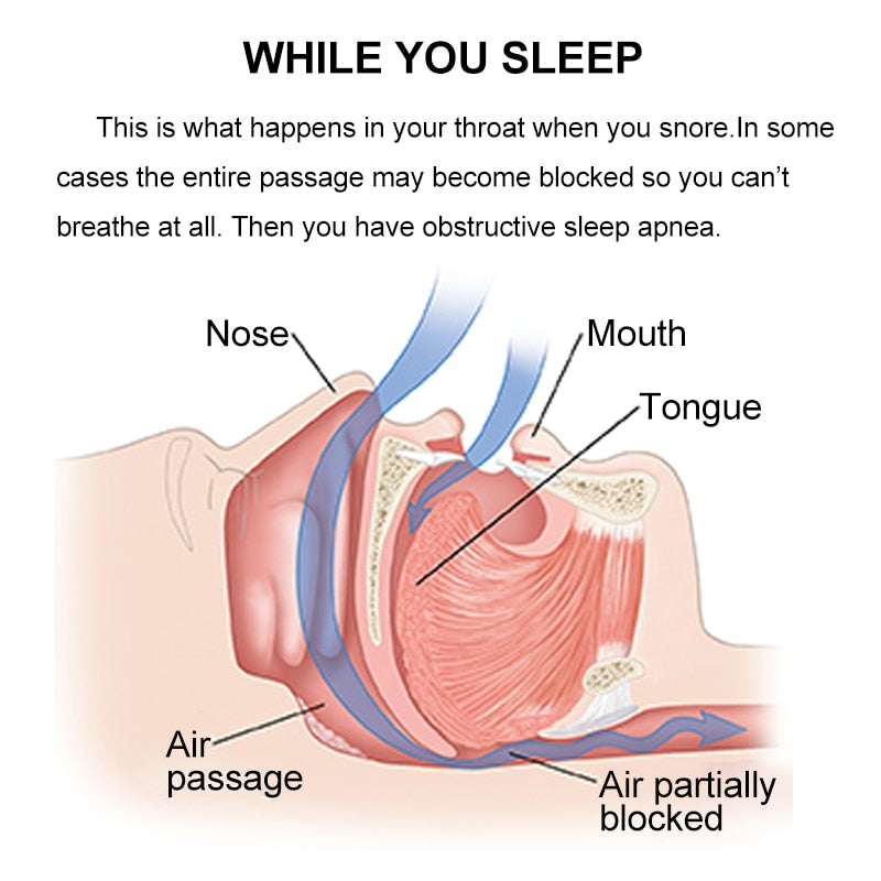 Silicone Magnetic Anti Snore Stop Snoring Nose Clip Sleep Tray Sleeping Aid Apnea Guard Night Device with Case