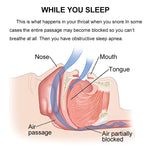 Silicone Magnetic Anti Snore Stop Snoring Nose Clip Sleep Tray Sleeping Aid Apnea Guard Night Device with Case